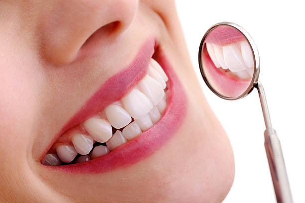 Teeth White
