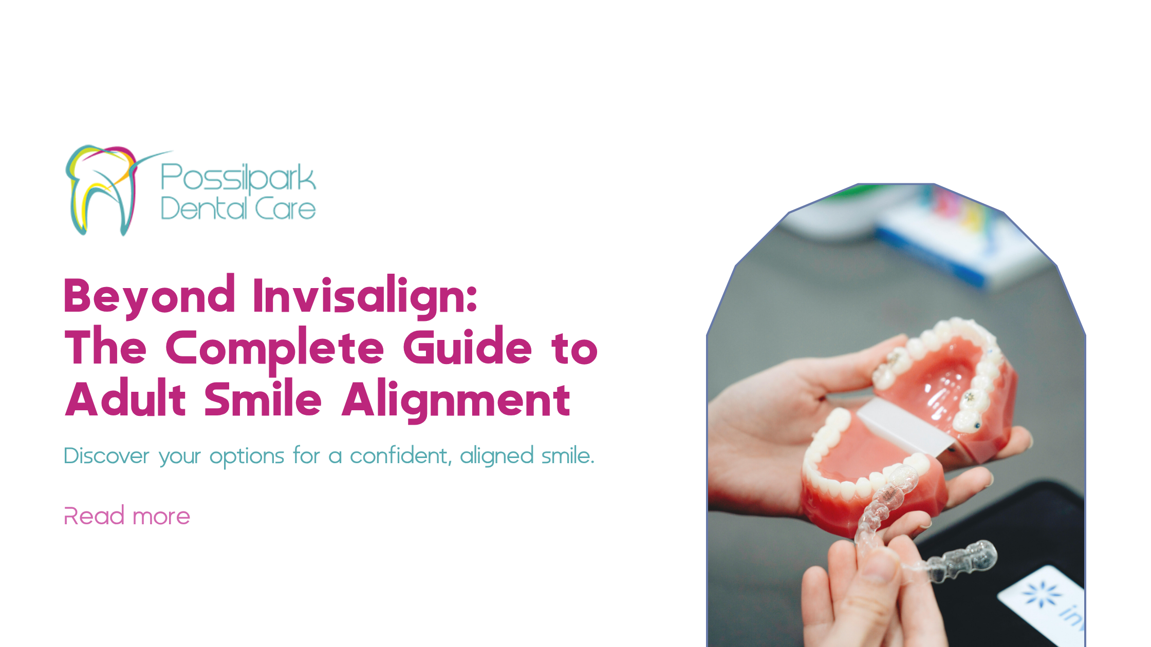 Beyond Invisalign: The Complete Guide to Adult Smile Alignment