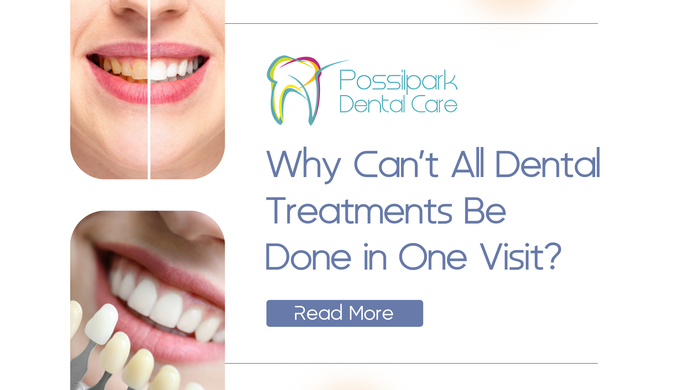 Why Can’t All Dental Treatments Be Done in One Visit? | Possilpark