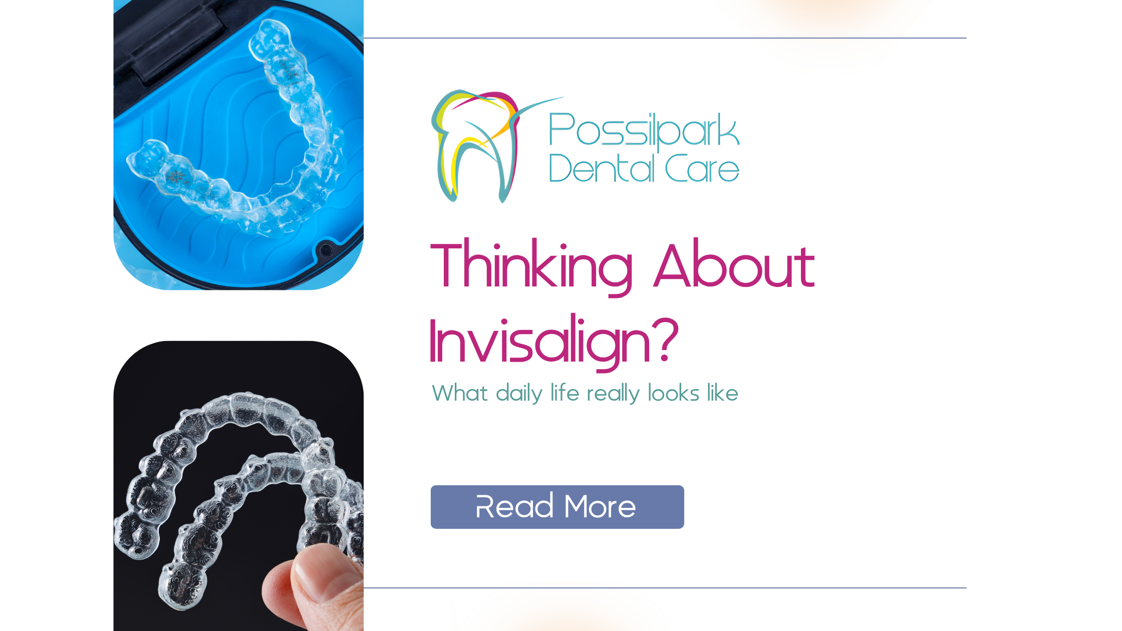 Considering Invisalign as an Adult? What to Expect Day to Day 